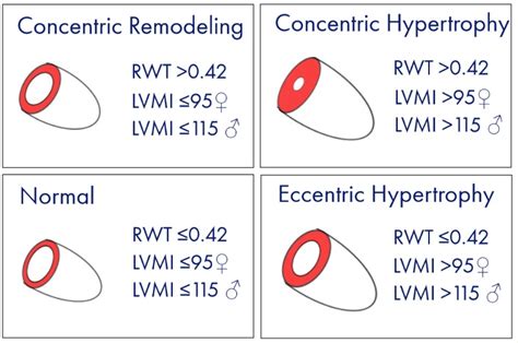 lvmi echo calculator